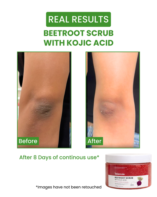 Beetroot Kojic Scrub (Pigmentation, Tan & Glow)