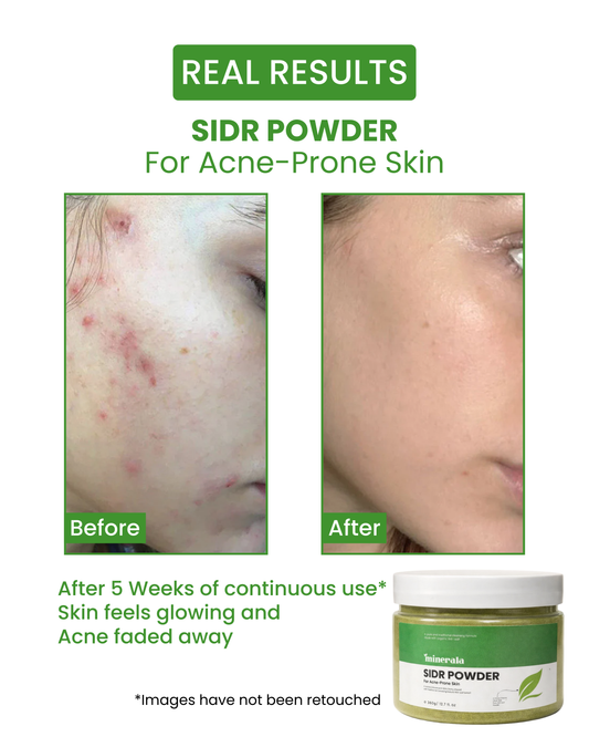Sidr Powder (External Acne Cleanse Mask)